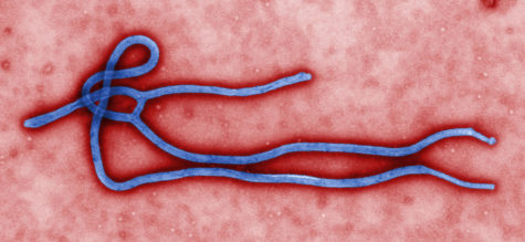 United States ill-prepared to handle Ebola crisis